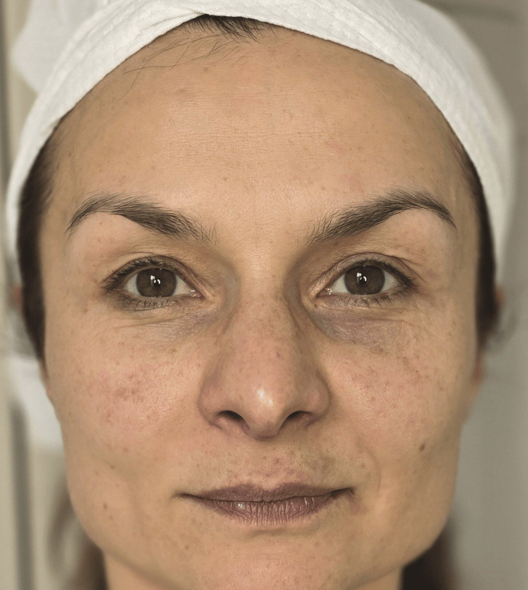 Testimonial Modal video thumbnail